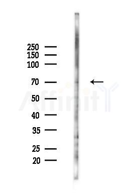 ADAM8 Antibody - Western blot analysis of lysates from Hela cells(heat-shock 45min treatment), using ADAM8 Antibody at 1/1000 dilution.