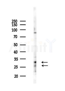 CLEC6A Antibody - Western blot analysis of lysates from HUVEC cells(starvation 24h treatment), using CLEC6A Antibody at 1/1000 dilution.