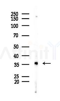 OR2B3 Antibody - Western blot analysis of lysates from B16F10-LUC cells(UV 30min treatment), using OR2B3 Antibody at 1/1000 dilution.