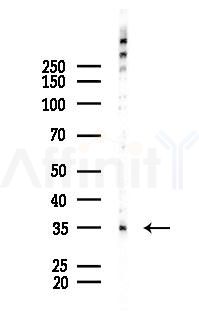 OR Antibody - Western blot analysis of lysates from B16F10-LUC cells(UV 30min treatment), using OR Antibody at 1/1000 dilution.