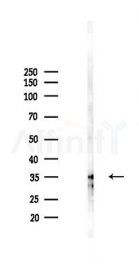 VN1R1 Antibody - Western blot analysis of lysates from COLO205 cells(starvation 24h treatment), using VN1R1 Antibody at 1/1000 dilution.