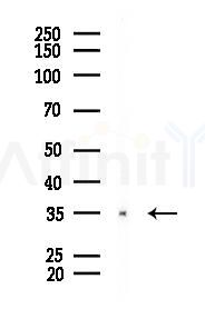 OR56A4/5 Antibody - Western blot analysis of lysates from B16F10-LUC cells(UV 30min treatment), using OR56A4/5 Antibody at 1/1000 dilution.