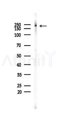 ABL1/2 Antibody - Western blot analysis of lysates from COLO205 cells(heat-shock 45min treatment), using ABL1/2 Antibody at 1/1000 dilution.