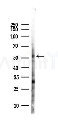 NDR1/2 Antibody - Western blot analysis of lysates from HUVEC cells(UV 30min treatment), using NDR1/2 Antibody at 1/1000 dilution.