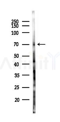ROS Antibody - Western blot analysis of lysates from Mouse brain, using ROS Antibody at 1/1000 dilution.