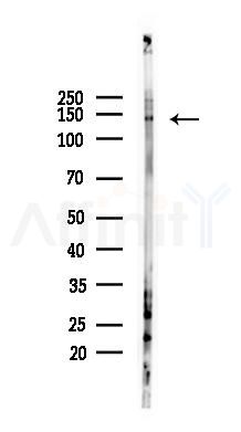 MER/TYRO3 Antibody - Western blot analysis of lysates from Rat brain, using MER/TYRO3 Antibody at 1/1000 dilution.