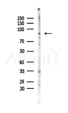 PLOD2 Antibody - Western blot analysis of lysates from K562 cells(LPS 4h treatment), using PLOD2 Antibody at 1/1000 dilution.