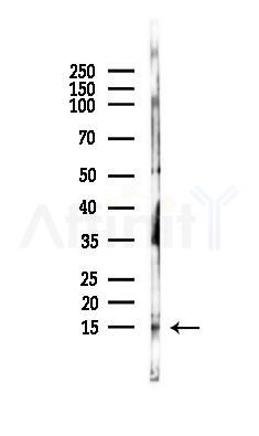 SRX1 Antibody - Western blot analysis of lysates from Rat spleen, using SRX1 Antibody at 1/1000 dilution.