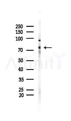 TCTN1 Antibody - Western blot analysis of lysates from Rat brain, using TCTN1 Antibody at 1/1000 dilution.