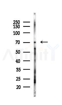 IFT81 Antibody - Western blot analysis of lysates from 293 cells(UV 30min treatment), using IFT81 Antibody at 1/1000 dilution.
