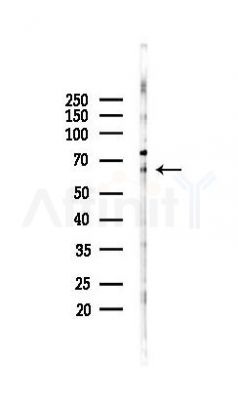 SQLE Antibody - Western blot analysis of lysates from B16F10-LUC cells(LPS 4h treatment), using SQLE Antibody at 1/1000 dilution.