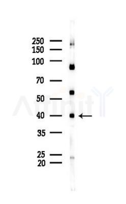 IST1 Antibody - Western blot analysis of lysates from K562 cells(heat-shock 45min treatment), using IST1 Antibody at 1/1000 dilution.