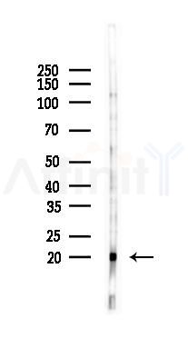 Centrin 1 Antibody - Western blot analysis of lysates from K562 cells(UV 30min treatment), using Centrin 1 Antibody at 1/1000 dilution.