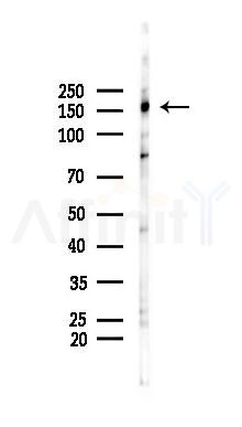 Liprin alpha 1 Antibody - Western blot analysis of lysates from Rat brain, using Liprin alpha 1 Antibody at 1/1000 dilution.