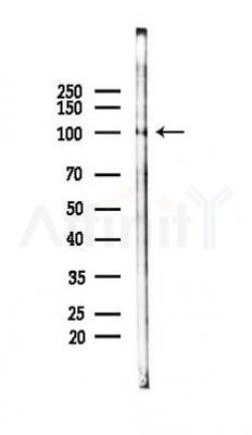 AGGF1 Antibody - Western blot analysis of lysates from K562 cells(LPS 4h treatment), using AGGF1 Antibody at 1/1000 dilution.