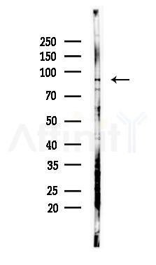 OSBP Antibody - Western blot analysis of lysates from PC12 cells(starvation 24h treatment), using OSBP Antibody at 1/1000 dilution.