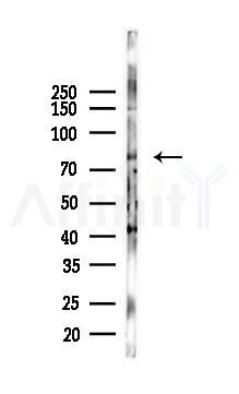ACSL4/FACL4 Antibody - Western blot analysis of lysates from HepG2 cells(heat-shock 45min treatment), using ACSL4/FACL4 Antibody at 1/1000 dilution.