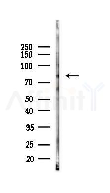 ACSL4/FACL4 Antibody - Western blot analysis of lysates from RAW264.