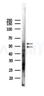 SNX17 Antibody - Western blot analysis of lysates from Hela cells(LPS 4h treatment), using SNX17 Antibody at 1/1000 dilution.