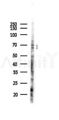 YTHDF2 Antibody - Western blot analysis of lysates from Hela cells(LPS 4h treatment), using YTHDF2 Antibody at 1/1000 dilution.