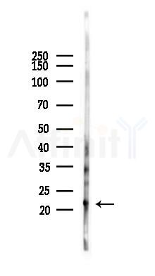 COQ7 Antibody - Western blot analysis of lysates from Mouse brain, using COQ7 Antibody at 1/1000 dilution.