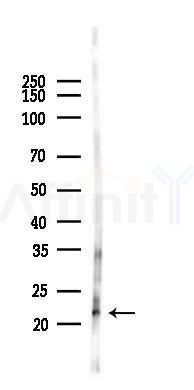 COQ7 Antibody - Western blot analysis of lysates from Rat liver, using COQ7 Antibody at 1/1000 dilution.