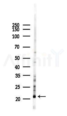 COQ7 Antibody - Western blot analysis of lysates from Hela cells(LPS 4h treatment), using COQ7 Antibody at 1/1000 dilution.