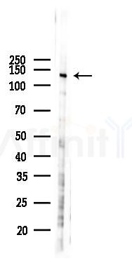 DHX38 Antibody - Western blot analysis of lysates from Hela cells(LPS 4h treatment), using DHX38 Antibody at 1/1000 dilution.