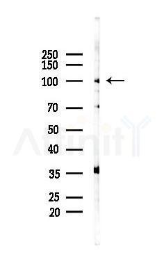 KIFC3 Antibody - Western blot analysis of lysates from K562 cells(LPS 4h treatment), using KIFC3 Antibody at 1/1000 dilution.