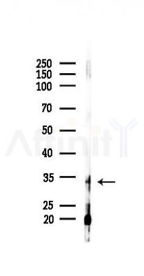 MEST Antibody - Western blot analysis of lysates from HepG2 cells(heat-shock 45min treatment), using MEST Antibody at 1/1000 dilution.