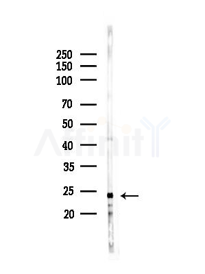 NDUFS7 Antibody - Western blot analysis of lysates from HepG2 cells(heat-shock,45min treatment), using NDUFS7 Antibody at 1/1000 dilution.