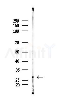 C14orf166 Antibody - Western blot analysis of lysates from Rat lung, using C14orf166 Antibody at 1/1000 dilution.