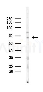 ERM / Etv5 Antibody - Western blot analysis of lysates from 293 cells(LPS 4h treatment), using ERM / Etv5 Antibody at 1/1000 dilution.