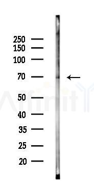 INSIG1 Antibody - Western blot analysis of lysates from Mouse muscle, using INSIG1 Antibody at 1/1000 dilution.