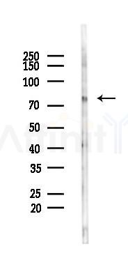 LGP2 Antibody - Western blot analysis of lysates from 293 cells(LPS 4h treatment), using LGP2 Antibody at 1/1000 dilution.