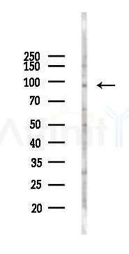 P3H3 Antibody - Western blot analysis of lysates from HUVEC cells(LPS 4h treatment), using P3H3 Antibody at 1/1000 dilution.