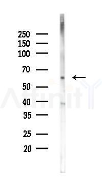 P4HA2 Antibody - Western blot analysis of lysates from Rat brain, using P4HA2 Antibody at 1/1000 dilution.