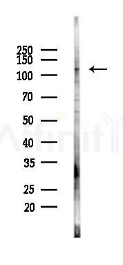PACS2 Antibody - Western blot analysis of lysates from B16F10-LUC cells(UV 30min treatment), using PACS2 Antibody at 1/1000 dilution.