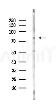 TBC1D23 Antibody - Western blot analysis of lysates from Mouse muscle, using TBC1D23 Antibody at 1/1000 dilution.