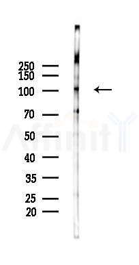 OSBL6 Antibody - Western blot analysis of lysates from K562 cells(heat-shock 45min treatment), using OSBL6 Antibody at 1/1000 dilution.