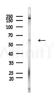 MMP24 Antibody - Western blot analysis of lysates from Hela cells(heat-shock 45min treatment), using MMP24 Antibody at 1/1000 dilution.