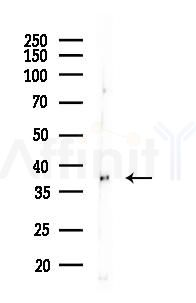 TREM2 Antibody - Western blot analysis of lysates from RAW264.