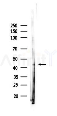 KDM8 Antibody - Western blot analysis of lysates from PC12 cells(starvation 24h treatment), using KDM8 Antibody at 1/1000 dilution.