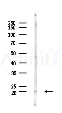 BTG1 Antibody - Western blot analysis of lysates from Rat liver, using BTG1 Antibody at 1/1000 dilution.