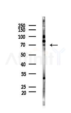 CCDC120 Antibody - Western blot analysis of lysates from B16F10-LUC cells(UV 30min treatment), using CCDC120 Antibody at 1/1000 dilution.