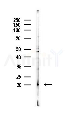 G0S2 Antibody - Western blot analysis of lysates from COLO205 cells(starvation 24h treatment), using G0S2 Antibody at 1/1000 dilution.