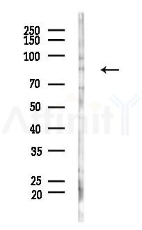 GGCX Antibody - Western blot analysis of lysates from B16F10-LUC cells(UV 30min treatment), using GGCX Antibody at 1/1000 dilution.