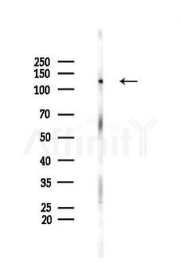 GPNMB Antibody - Western blot analysis of lysates from Rat brain, using GPNMB Antibody at 1/1000 dilution.