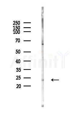 Hikeshi Antibody - Western blot analysis of lysates from Mouse muscle, using Hikeshi Antibody at 1/1000 dilution.