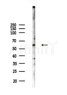 IgG4 Antibody - Western blot analysis of lysates from 293 cells(LPS 4h treatment), using IgG4 Antibody at 1/1000 dilution.